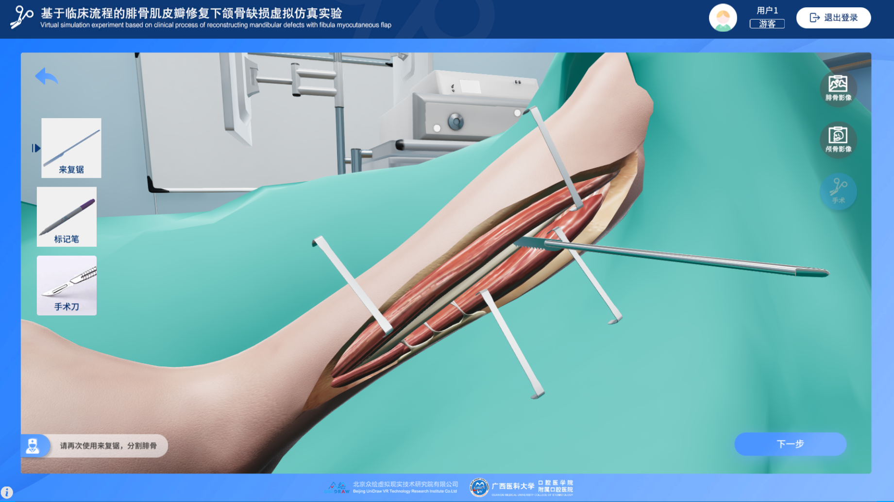 基于临床流程的腓骨肌皮瓣修复下颌骨缺损虚拟仿真实验教学系统